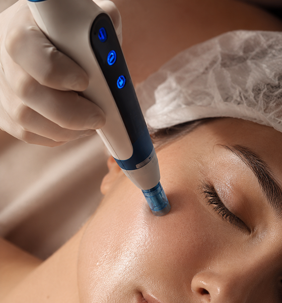 Microneedling (Skin Rejuvenation)
